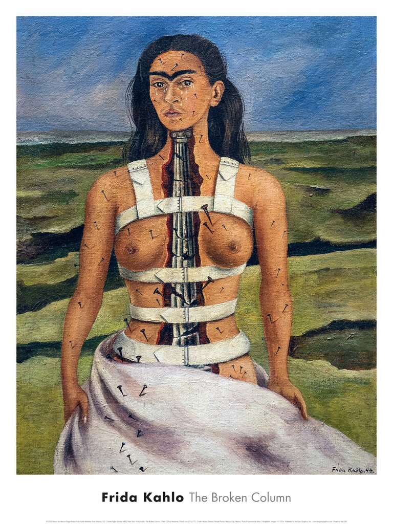 The Broken Column, 1944 by Frida Kahlo Art Print Poster 18×24